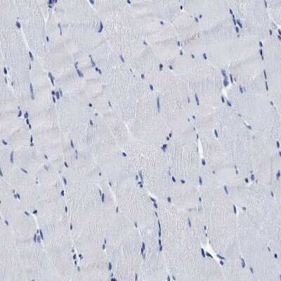 Immunohistochemistry-Paraffin: YARS Antibody [NBP1-86890]