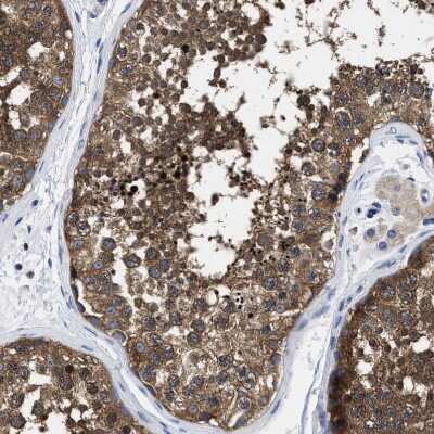 Immunohistochemistry-Paraffin: YARS Antibody [NBP1-86890]