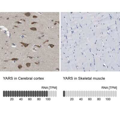 Immunohistochemistry-Paraffin: YARS Antibody [NBP1-86890]