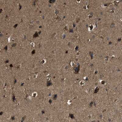 Immunohistochemistry-Paraffin: YARS Antibody [NBP1-86891]