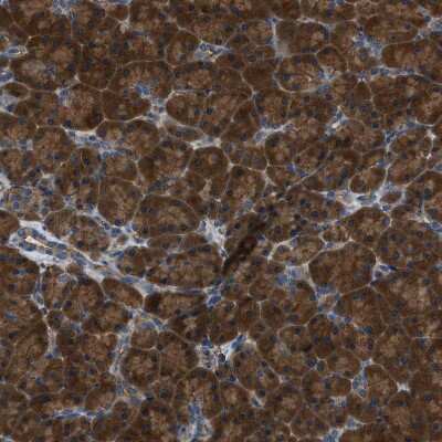 Immunohistochemistry-Paraffin: YARS Antibody [NBP1-86891]