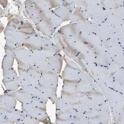 Immunohistochemistry-Paraffin: YARS Antibody [NBP1-86891]