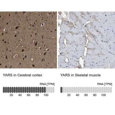 Immunohistochemistry-Paraffin: YARS Antibody [NBP1-86891]