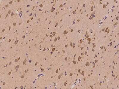 Immunohistochemistry-Paraffin: YARS Antibody [NBP2-98605]