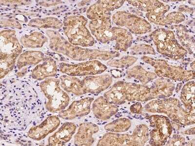 Immunohistochemistry-Paraffin: YARS Antibody [NBP2-98605]