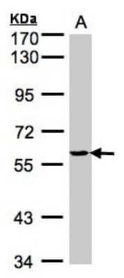 Western Blot: YARS Antibody [NBP1-32551]