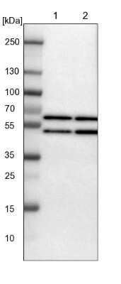 Western Blot: YARS Antibody [NBP1-86890]