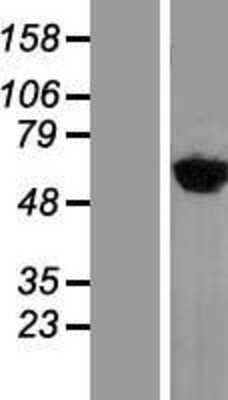 Western Blot: YARS Overexpression Lysate [NBL1-17924]