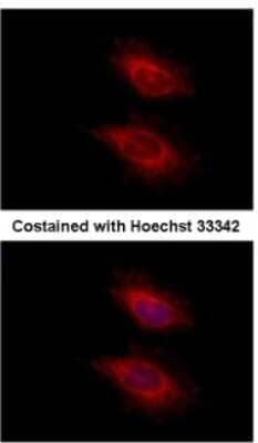 Immunocytochemistry/ Immunofluorescence: YARS2 Antibody [NBP2-20929]
