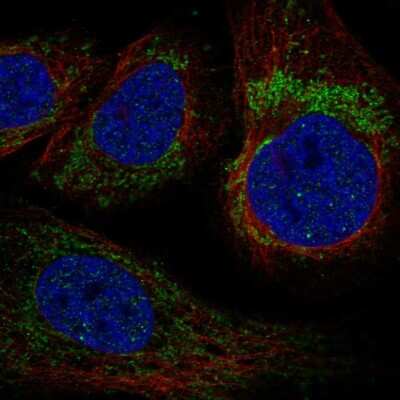 Immunocytochemistry/ Immunofluorescence: YARS2 Antibody [NBP2-56297]