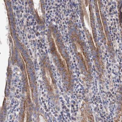 Immunohistochemistry-Paraffin: YARS2 Antibody [NBP1-84525]