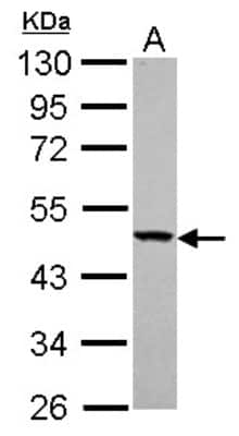 Western Blot: YARS2 Antibody [NBP2-20928]