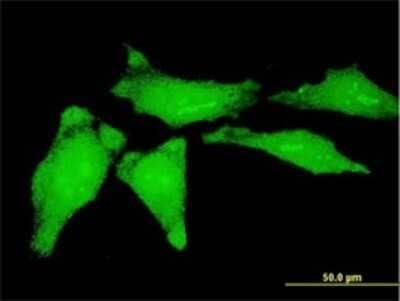 Immunocytochemistry/ Immunofluorescence: YB1 Antibody (4C7) [H00004904-M02]