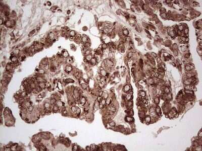 Immunohistochemistry: YB1 Antibody (OTI7B4) [NBP2-46381]