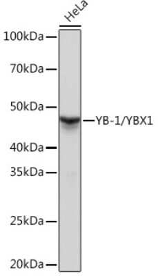 Western Blot: YB1 Antibody (9J7M4) [NBP3-16213]