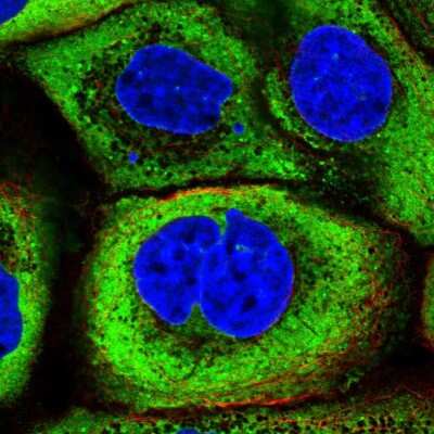 Immunocytochemistry/ Immunofluorescence: YB1 Antibody [NBP2-58086]