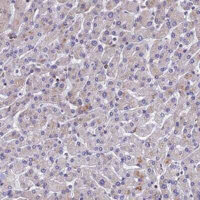 Immunohistochemistry-Paraffin: YB1 Antibody [NBP1-89945]