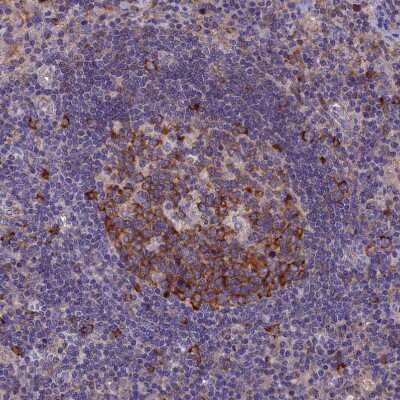 Immunohistochemistry-Paraffin: YB1 Antibody [NBP1-89945]