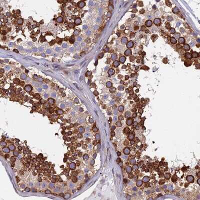 Immunohistochemistry-Paraffin: YB1 Antibody [NBP1-89945]