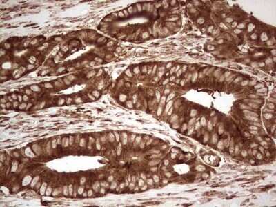 Immunohistochemistry: YB1 Antibody (OTI7B4) - Azide and BSA Free [NBP2-74905]