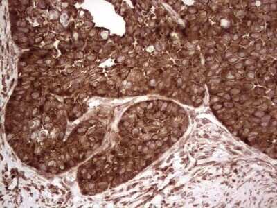 Immunohistochemistry: YB1 Antibody (OTI7B4) - Azide and BSA Free [NBP2-74905]