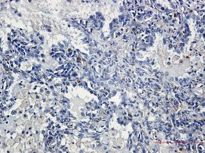 Immunohistochemistry-Paraffin: YB1 Antibody (S03-6G4) [NBP3-19806]