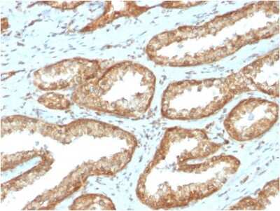 Immunohistochemistry-Paraffin: YB1 Antibody (YBX1/2430) [NBP3-07452]