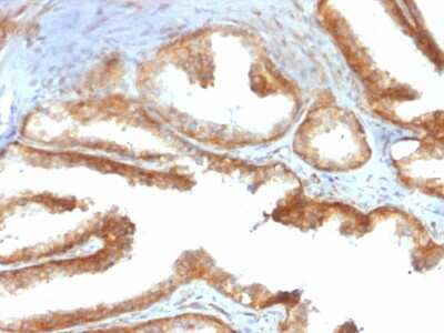 Immunohistochemistry-Paraffin: YB1 Antibody (rYBX1/2430) - Azide and BSA Free [NBP3-08783]