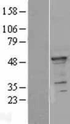 Western Blot: YB1 Overexpression Lysate [NBP2-10530]