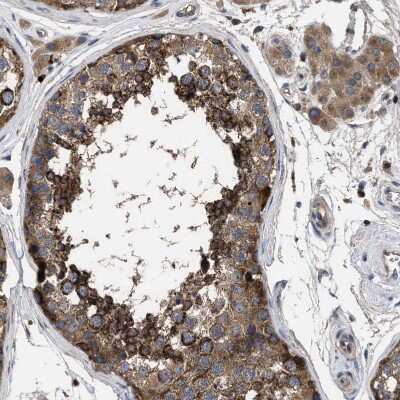 Immunohistochemistry-Paraffin: YBEY Antibody [NBP1-89876]