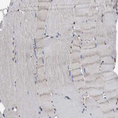 Immunohistochemistry-Paraffin: YBEY Antibody [NBP1-89876]