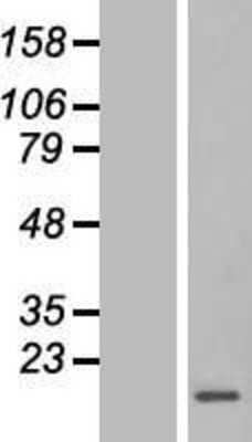 Western Blot: YBEY Overexpression Lysate [NBL1-08387]