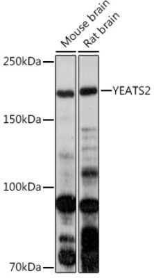 Western Blot: YEATS2 AntibodyAzide and BSA Free [NBP3-15583]