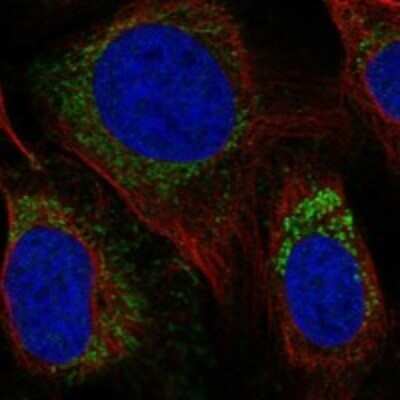 Immunocytochemistry/ Immunofluorescence: YF5 Antibody [NBP3-17964]