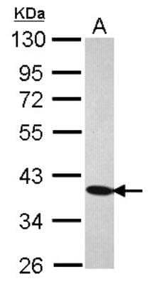 Western Blot: YF5 Antibody [NBP2-21571]