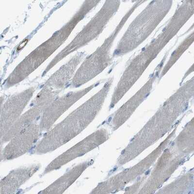 Immunohistochemistry-Paraffin: YIF1A Antibody [NBP1-89362]
