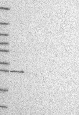 Western Blot: YIF1A Antibody [NBP3-17780]