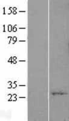 Western Blot: YIF1A Overexpression Lysate [NBL1-17929]