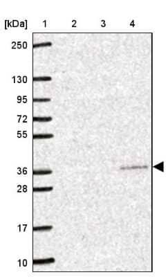 Western Blot: YIF1B Antibody [NBP2-49179]