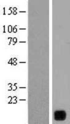 Western Blot: YIF1B Overexpression Lysate [NBL1-12616]