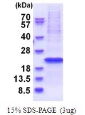 SDS-PAGE: Recombinant Human YIF1B His Protein [NBP2-51700]