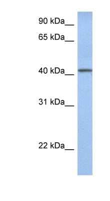 Western Blot: YIPF1 Antibody [NBP1-70750]