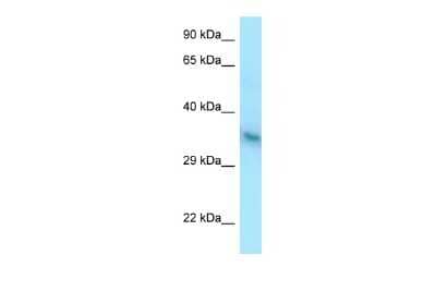 Western Blot: YIPF1 Antibody [NBP2-84274]