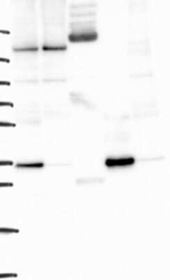 Western Blot: YIPF1 Antibody [NBP3-17560]