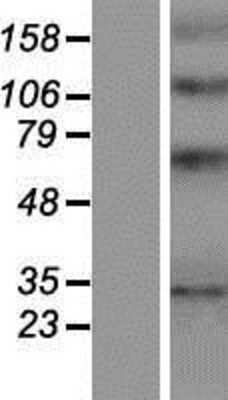 Western Blot: YIPF1 Overexpression Lysate [NBP2-06741]