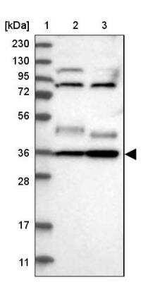 Western Blot: YIPF2 Antibody [NBP1-90458]