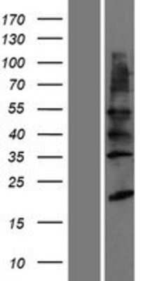 Western Blot: YIPF2 Overexpression Lysate [NBP2-06363]