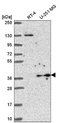 Western Blot: YIPF3 Antibody [NBP2-56181]