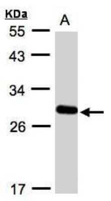 Western Blot: YIPF4 Antibody [NBP1-32497]