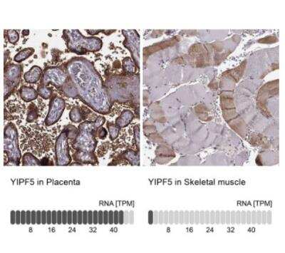 Immunohistochemistry-Paraffin: YIPF5 Antibody [NBP2-57970]